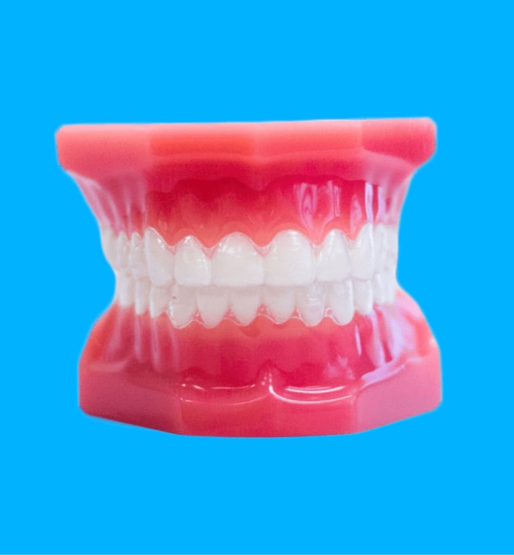 invisalign aligners on plastic model