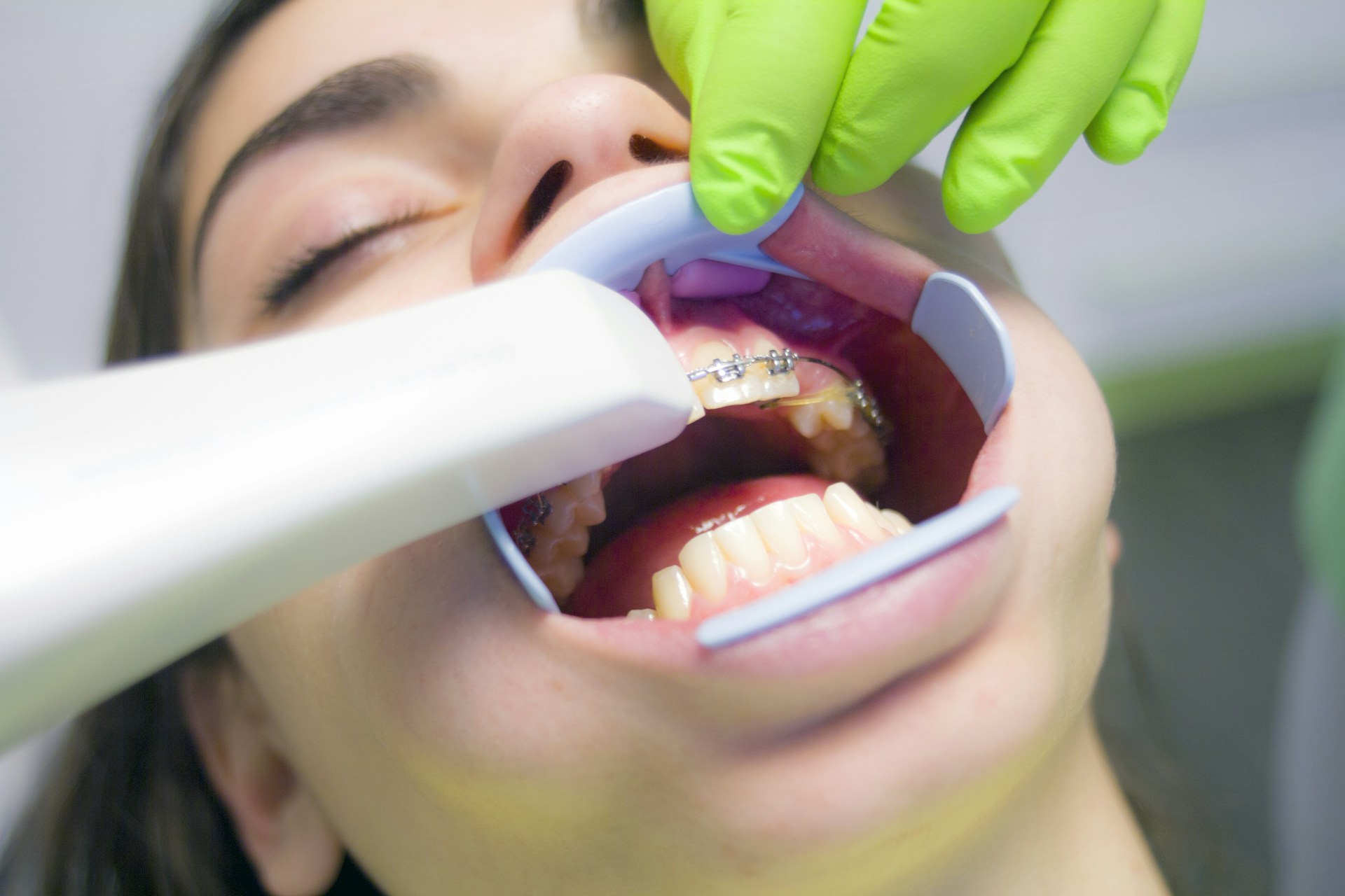 orthodontist working on teeth