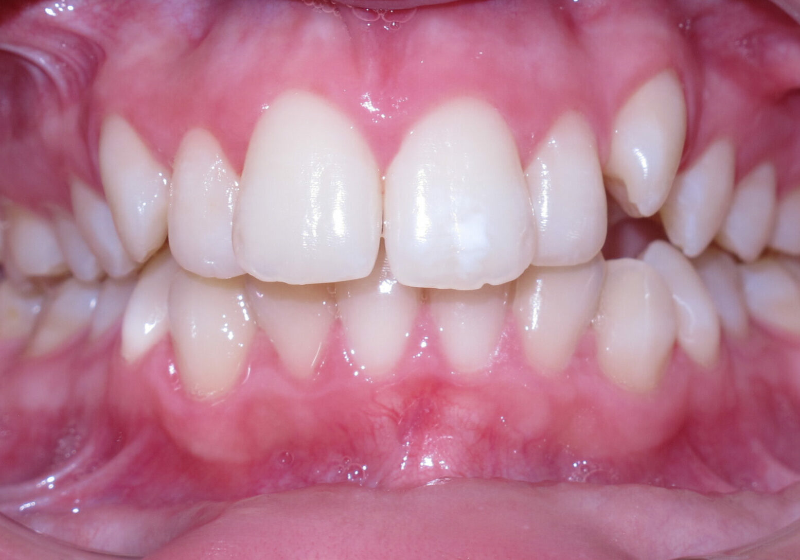 leander tx orthodontics