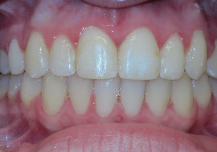 leander tx orthodontics